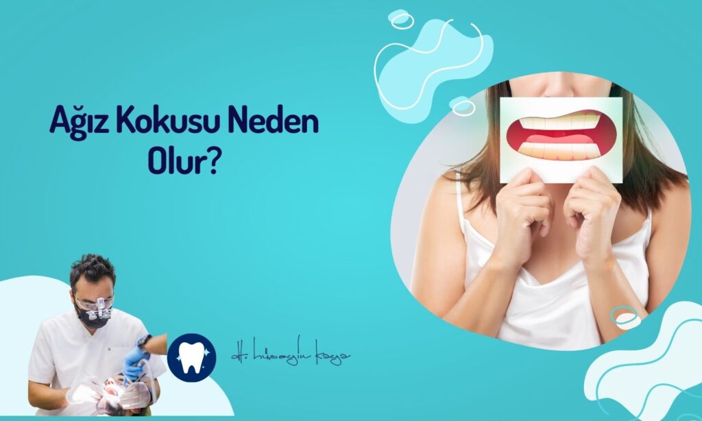 Ağız Kokusu Neden Olur? Nasıl Giderilir?