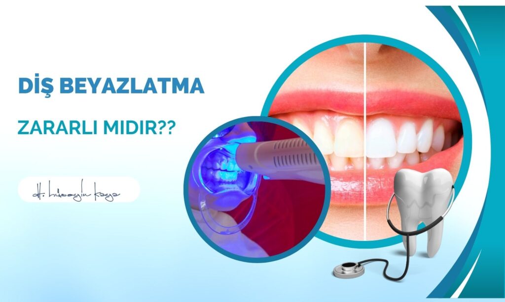 Diş Beyazlatma Zararlı Mıdır?