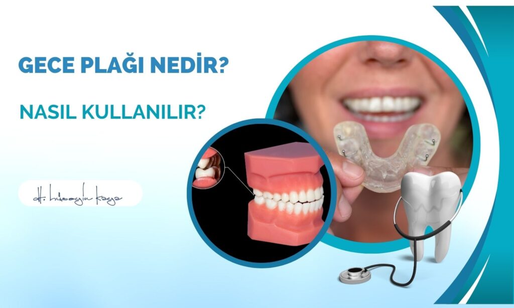 Gece Plağı Nedir? Nasıl Kullanılır?