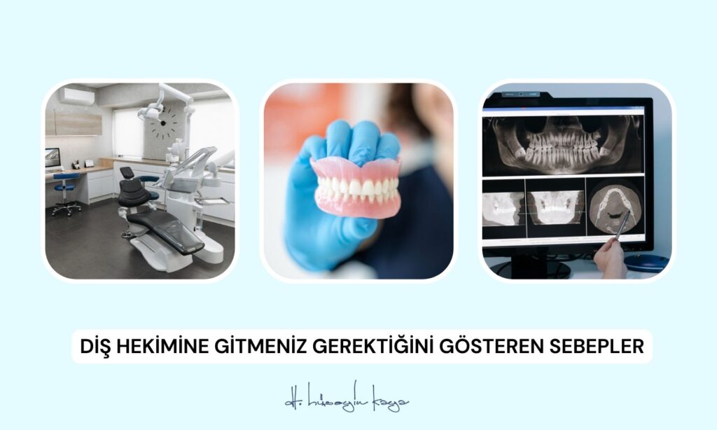 Diş Hekimine Gitmeniz Gerektiğini Gösteren Sebepler