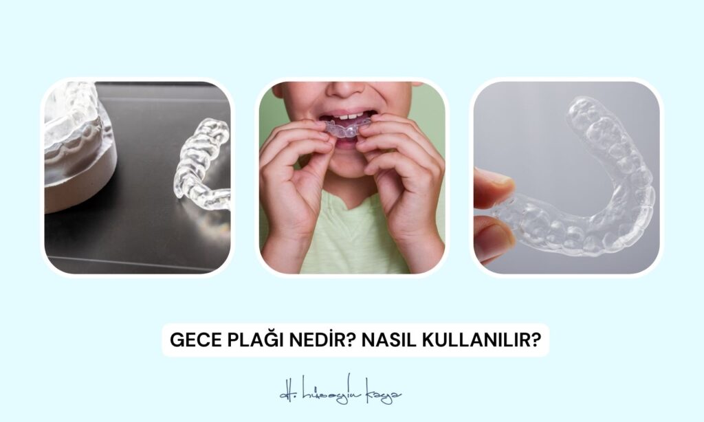 Gece Plağı Nedir? Nasıl Kullanılır?