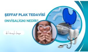 Şeffaf Plak Tedavisi (Invisalign) Nedir?