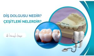 Diş Dolgusu Nedir? Çeşitleri Nelerdir?