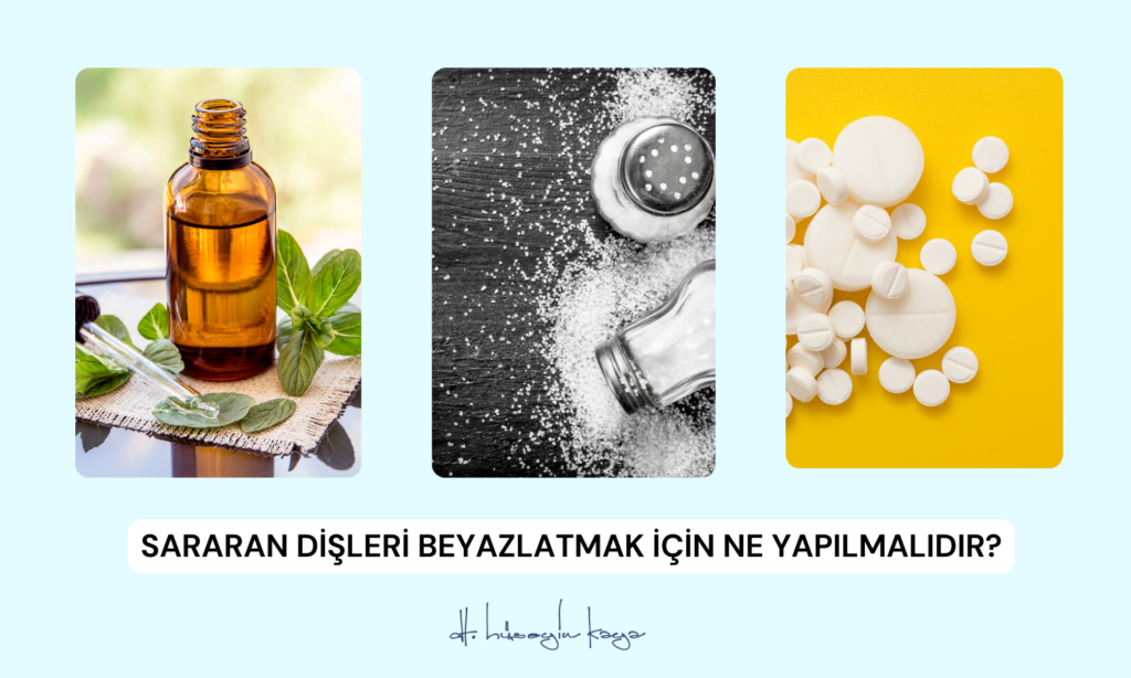 İltihaplı Diş Ağrısına Ne İyi Gelir?