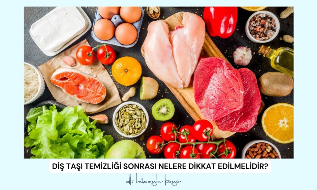 Diş Taşı Temizliği Sonrası Nelere Dikkat Edilmelidir?