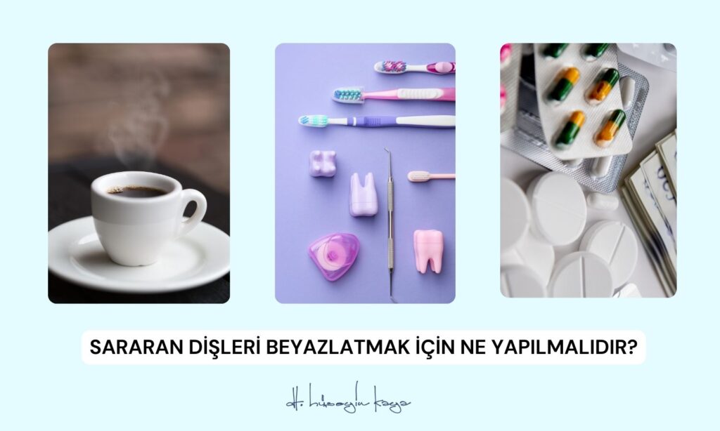 Sararan Dişleri Beyazlatmak İçin Ne Yapılmalıdır?