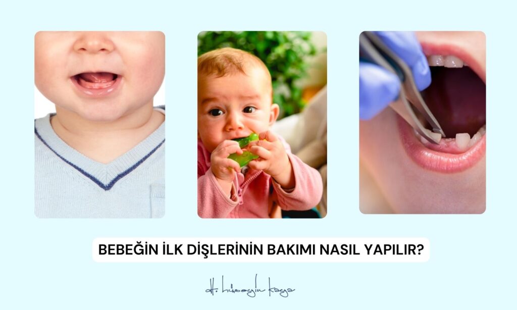 Bebeğin İlk Dişlerinin Bakımı Nasıl Yapılır?