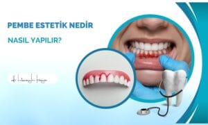 Pembe Estetik Nedir, Nasıl Yapılır?