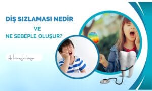 Diş Sızlaması Nedir ve Ne Sebeple Oluşur?