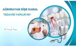 Ağrımayan Dişe Kanal Tedavisi Yapılır mı?