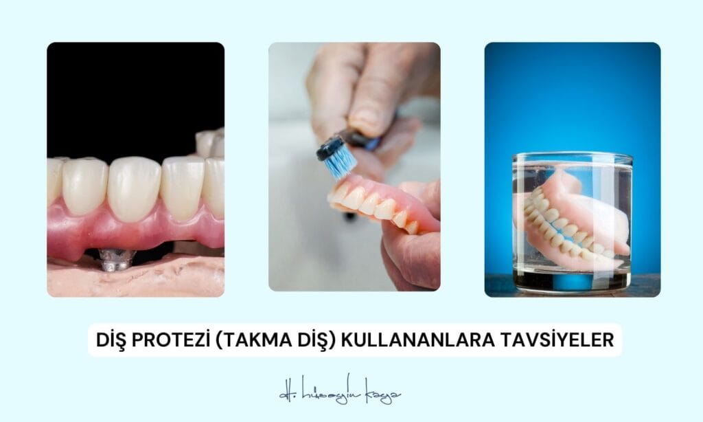 Diş Protezi (Takma Diş) Kullananlara Tavsiyeler
