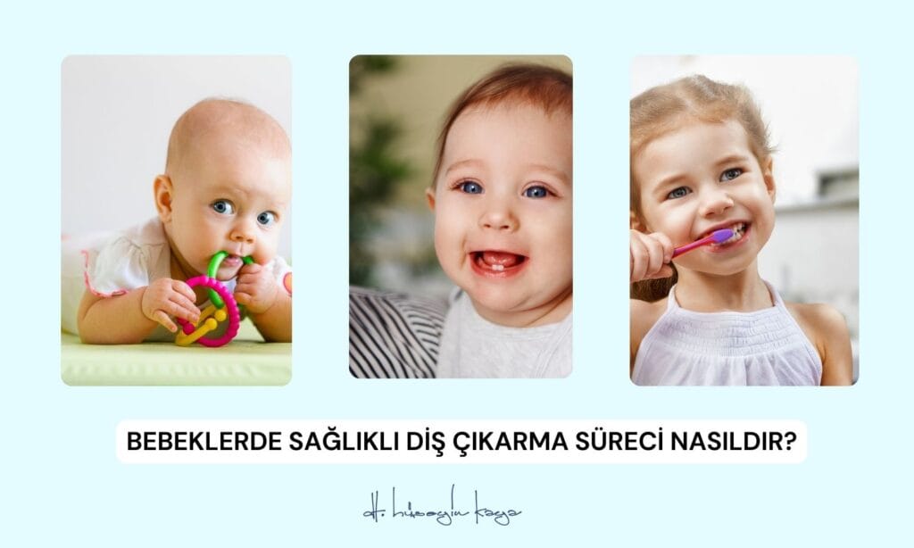 Bebeklerde Sağlıklı Diş Çıkarma Süreci Nasıldır?