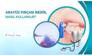 Arayüz Fırçası Nedir, Nasıl Kullanılır?
