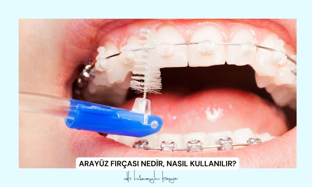 Arayüz Fırçası Nedir, Nasıl Kullanılır?
