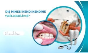 Diş Minesi Kendi Kendine Yenilenebilir mi?