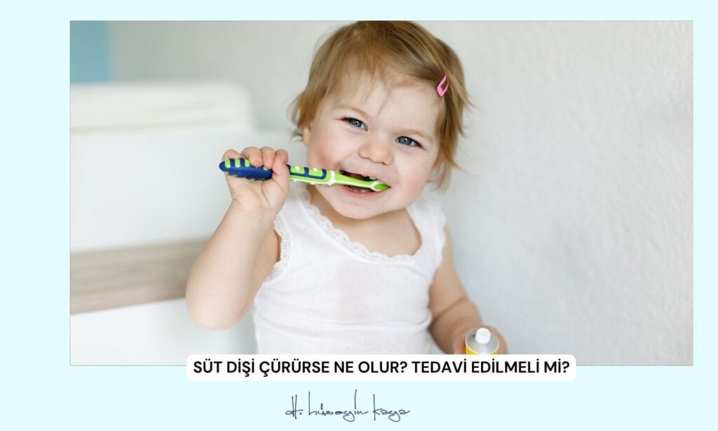 Süt Dişi Çürürse Ne Olur? Tedavi Edilmeli mi?
