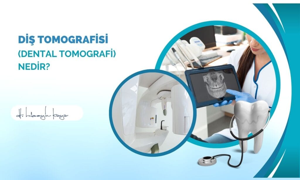 Diş Tomografisi (Dental Tomografi) Nedir?