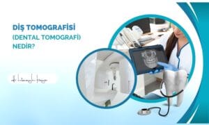 Diş Tomografisi (Dental Tomografi) Nedir?