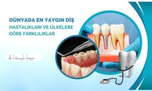 Dünyada En Yaygın Diş Hastalıkları ve Ülkelere Göre Farklılıklar