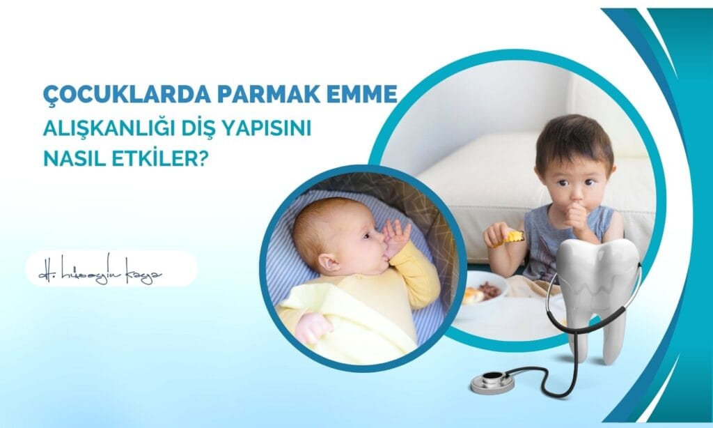 Çocuklarda Parmak Emme Alışkanlığı Diş Yapısını Nasıl Etkiler?