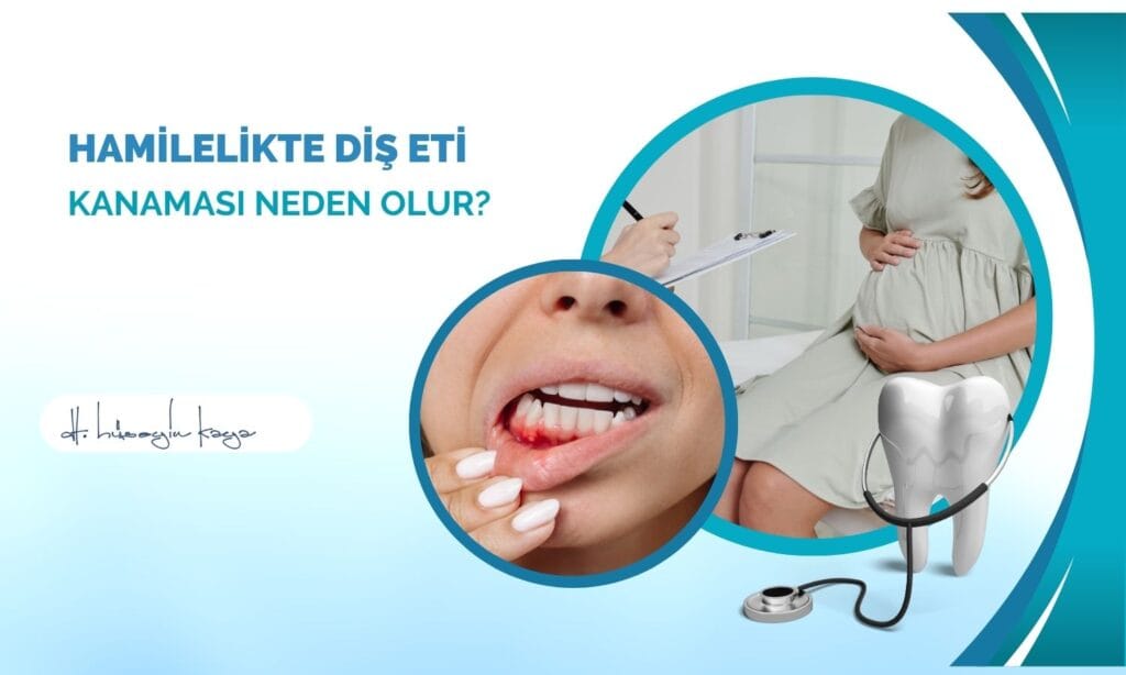 Hamilelikte Diş Eti Kanaması Neden Olur?