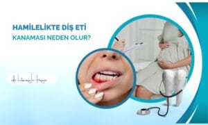 Hamilelikte Diş Eti Kanaması Neden Olur?