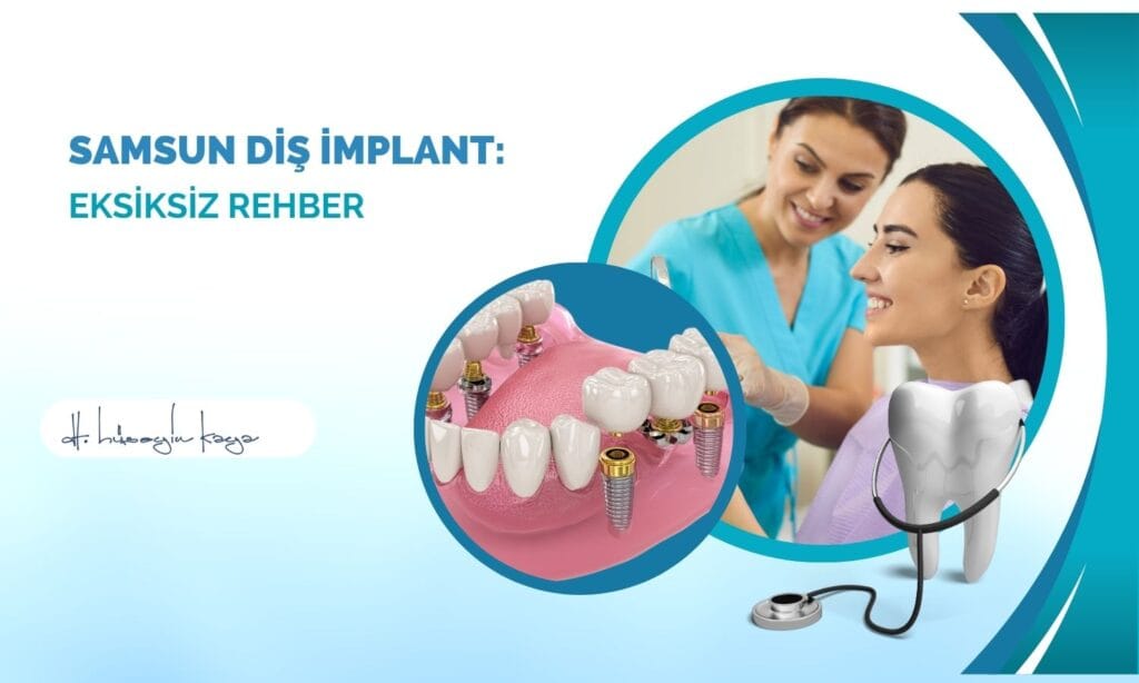 Samsun Diş İmplant: Eksiksiz Rehber
