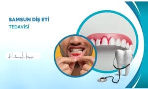 Samsun Diş Eti Tedavisi