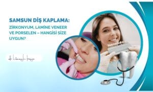 Samsun Diş Kaplama