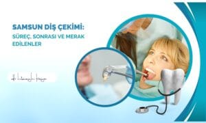Samsun Diş Çekimi: Süreç, Sonrası ve Merak Edilenler