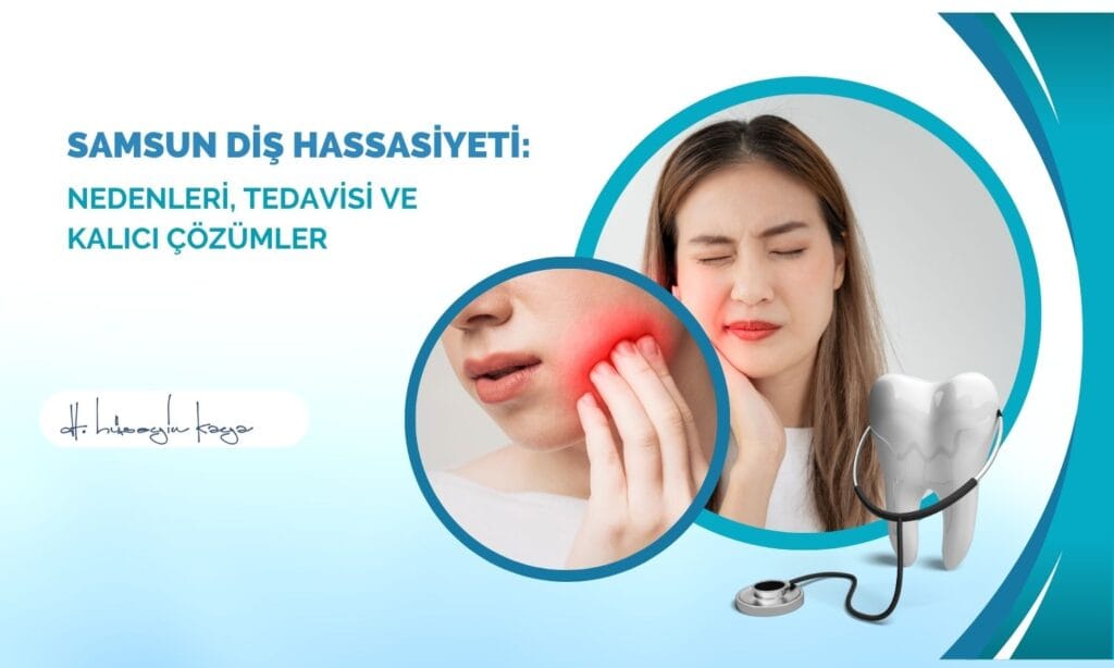 Samsun Diş Hassasiyeti: Nedenleri, Tedavisi ve Kalıcı Çözümler