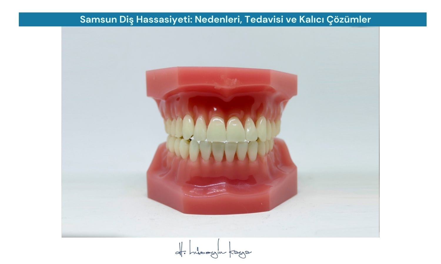 Samsun Diş Hassasiyeti: Nedenleri, Tedavisi ve Kalıcı Çözümler