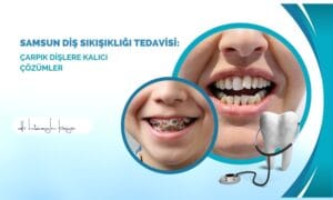 Samsun Diş Sıkışıklığı Tedavisi: Çarpık Dişlere Kalıcı Çözümler